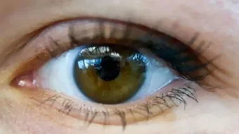 ما هي الأمراض التي تصيب العين