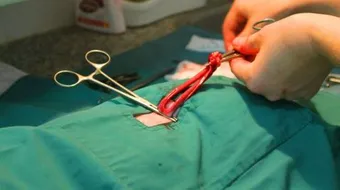 ماذا يحدث بعد إستئصال الرحم