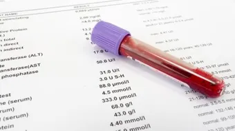 ما هو تحليل الدم الشامل