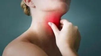 ما هو احتقان الحلق - فيديو