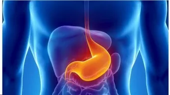 ما هي قرحة المعدة