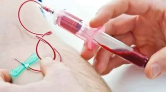 ما هو تحليل AFP