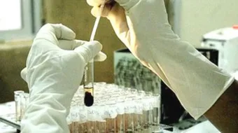 ما هو علاج الايدز