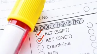 ما هو تحليل ALT