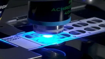 ما هو فحص ANA