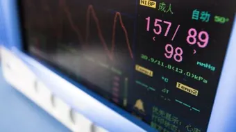 ما هو تخطيط القلب