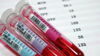 ما هو تحليل ANA