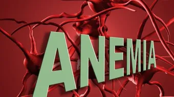 ما هي أنيميا الفول