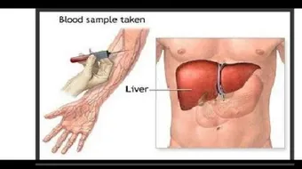 ما هو تحليل البيليروبين