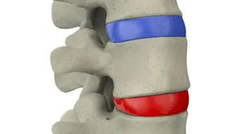 ما هو نخاع العظم