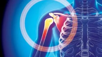 ما هي خشونة العظام