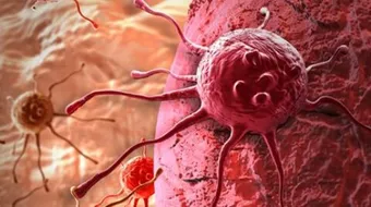 ما هو السرطان