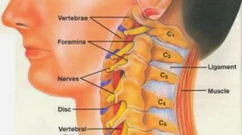 ما هو غضروف الرقبة