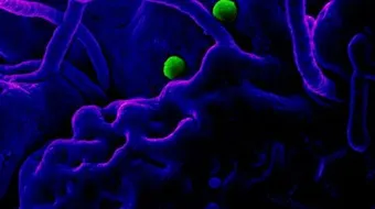 ما هو فيروس الكورونا