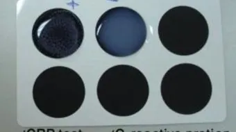 ما هو تحليل CRP