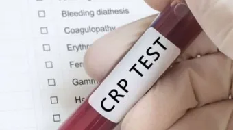 ما هو فحص CRP