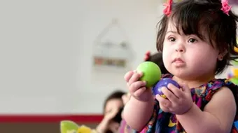 ما هي متلازمة داون