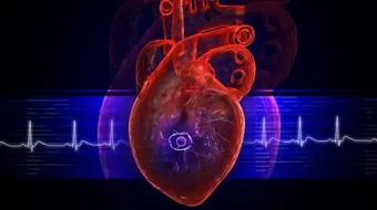 ما هو تضخم عضلة القلب