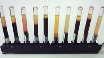 ما هو فحص ESR