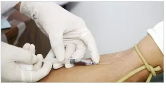 ما هو تحليل Hb Electrophoresis