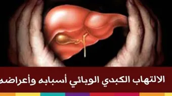 ما هو مرض الوباء الكبدي