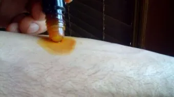 ما هو اليود