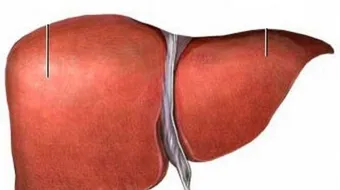 ما هو احتقان الكبد