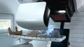 ما هو الإشعاع لعلاج السرطان