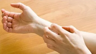 ما هو مرض الجرب أو الحكاك - فيديو