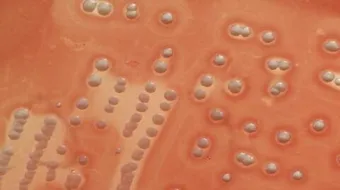 ما هو تسمم الدم