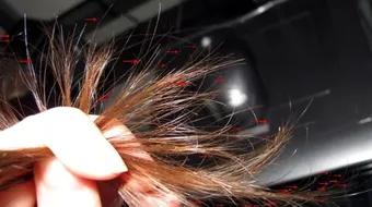 ما هو تقصف الشعر