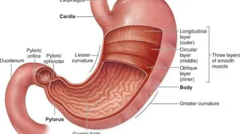 ما هو فتق المعدة