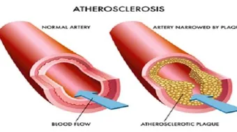 ما هو تحليل الدهون الثلاثية