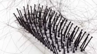 ما هو أفضل علاج لتساقط الشعر