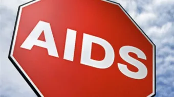 ما هو سبب مرض الايدز