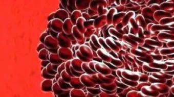 ما هو سبب تخثر الدم