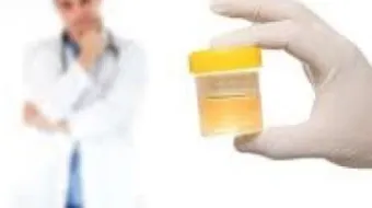 ما هو سبب حرقان البول