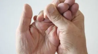 ما سبب تنميل الأطراف