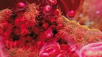 ما هو سبب نزول صفائح الدم