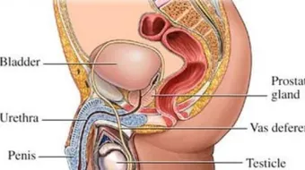 ما هو سبب احتقان البروستاتا