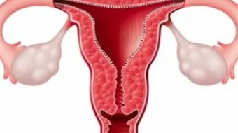 ما هو سبب سماكة بطانة الرحم