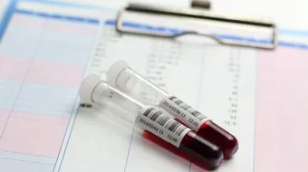 ما هو الفحص قبل الزواج