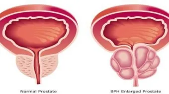 ما هي وظيفة البروستاتا