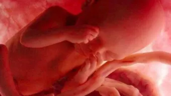 ما معنى اجهاض