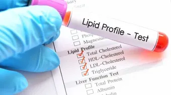 ما هي نسبة الكوليسترول الطبيعية