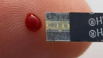 ما هو معدل السكر التراكمي الطبيعي