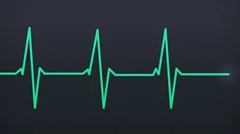 كم معدل نبض القلب الطبيعي