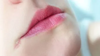 ما سبب تشقق زوايا الفم