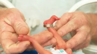 ما سبب الولادة المبكرة