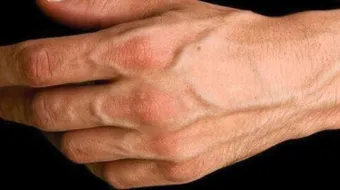 ما سبب بروز عروق اليد